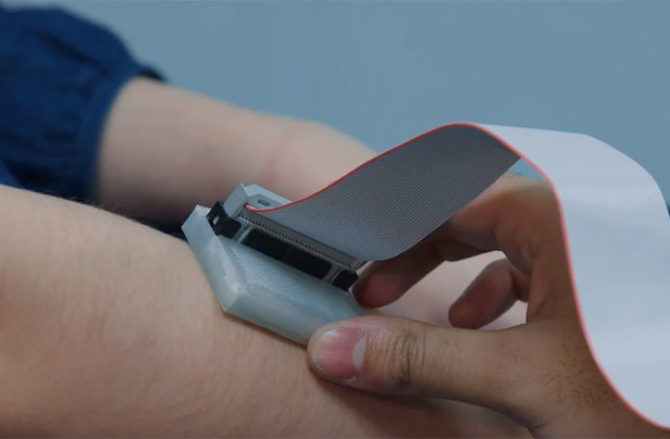 Skin Cancer Scanner